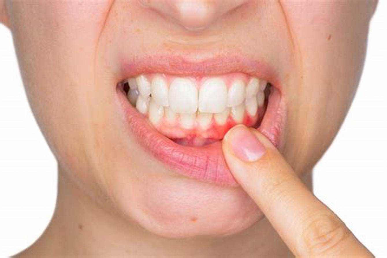 Las Emfermedades Periodontales Y La Pubertad