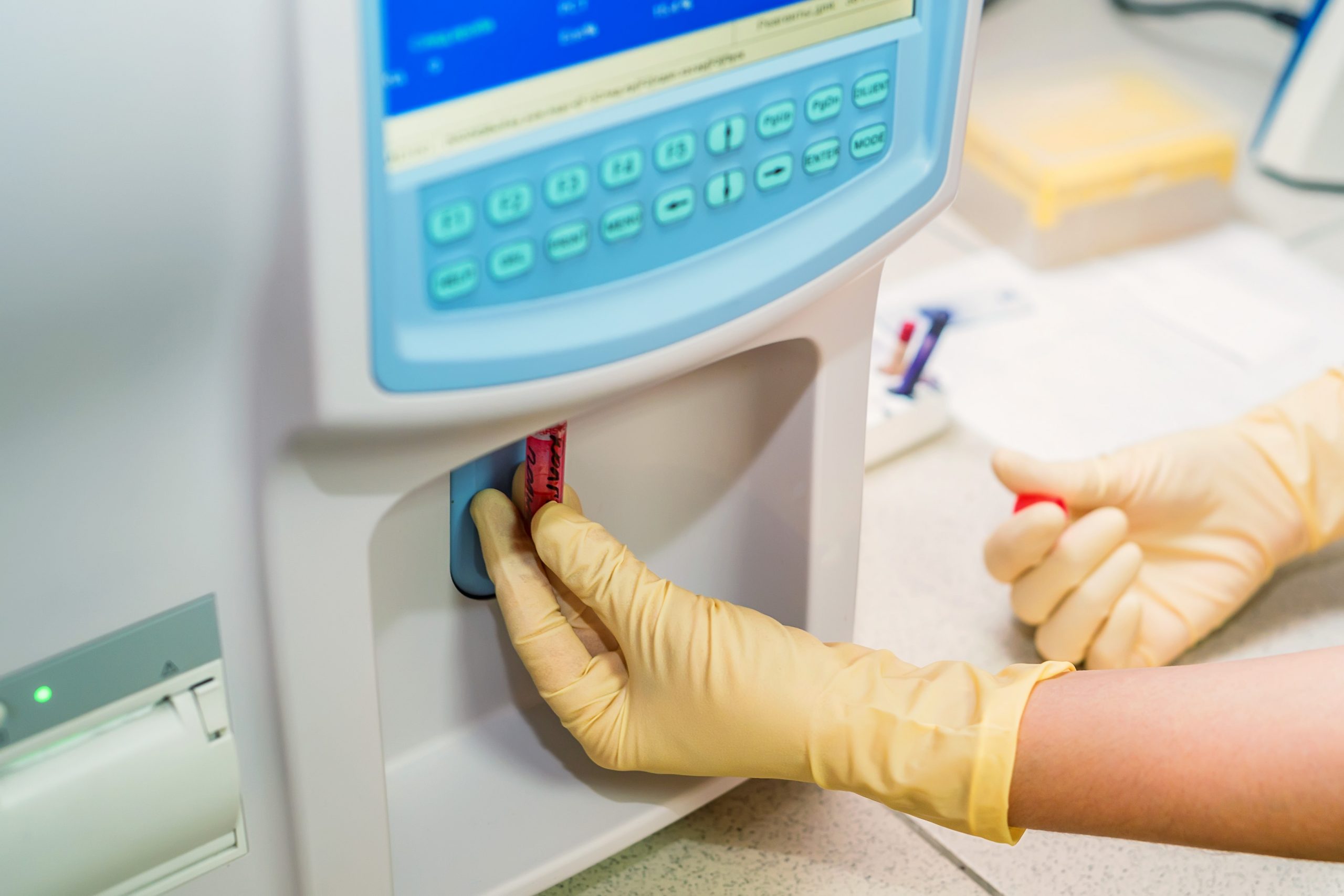 ¿Como funciona un analizador de quimica clinica?