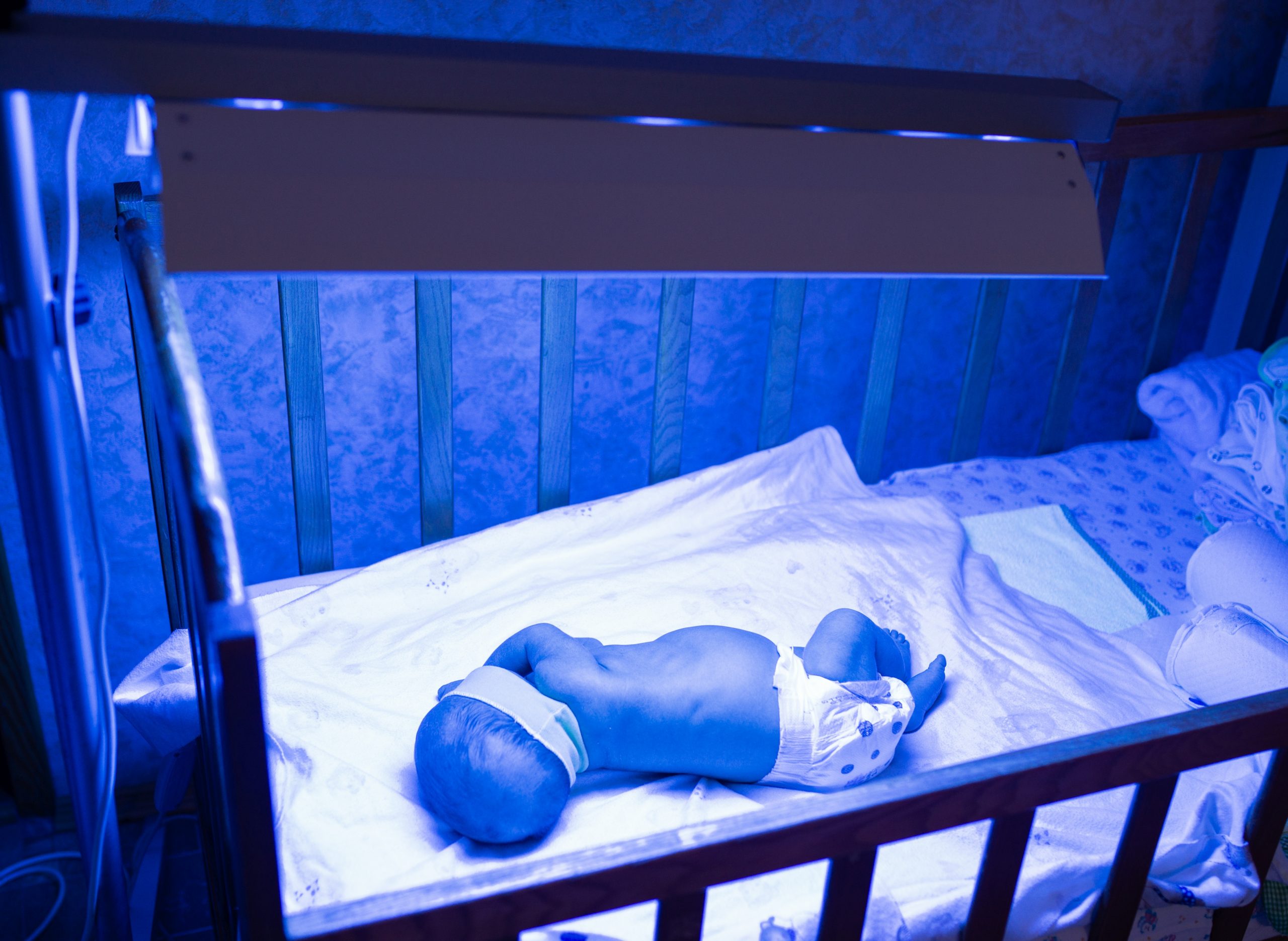¿Como funciona una unidad de fototerapia de bilirrubina infantil?