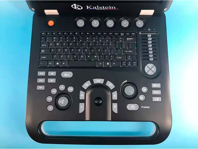 Innovación en Diagnóstico: La Revolución del Escáner de Ultrasonido en la Medicina Moderna