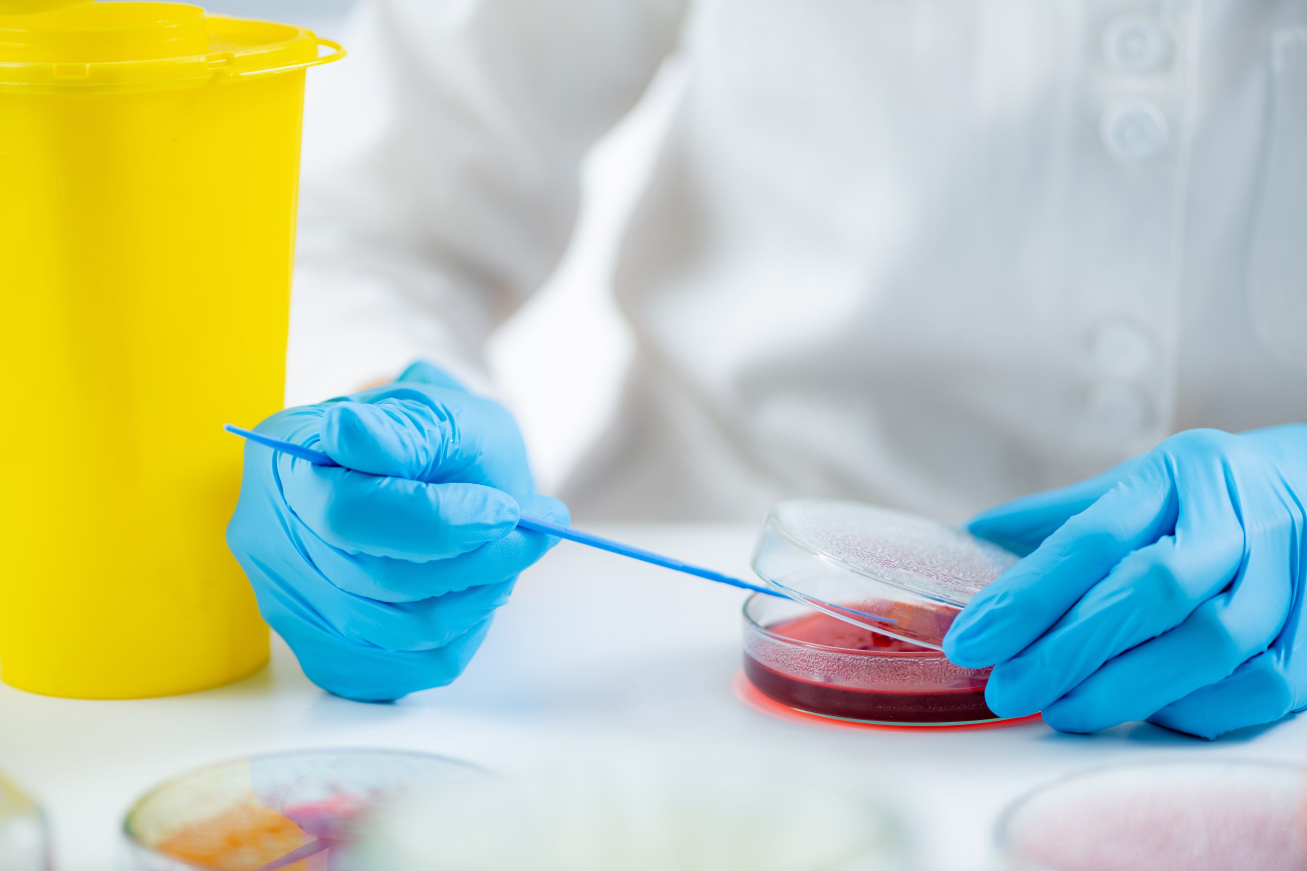 Tips para el buen funcionamiento del Lector de ELISA