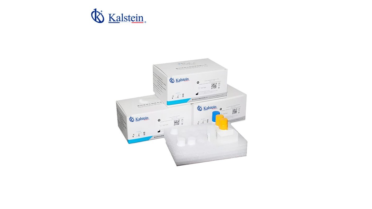 Guía Práctica de Uso de Reactivos de Quimioluminiscencia en 2026